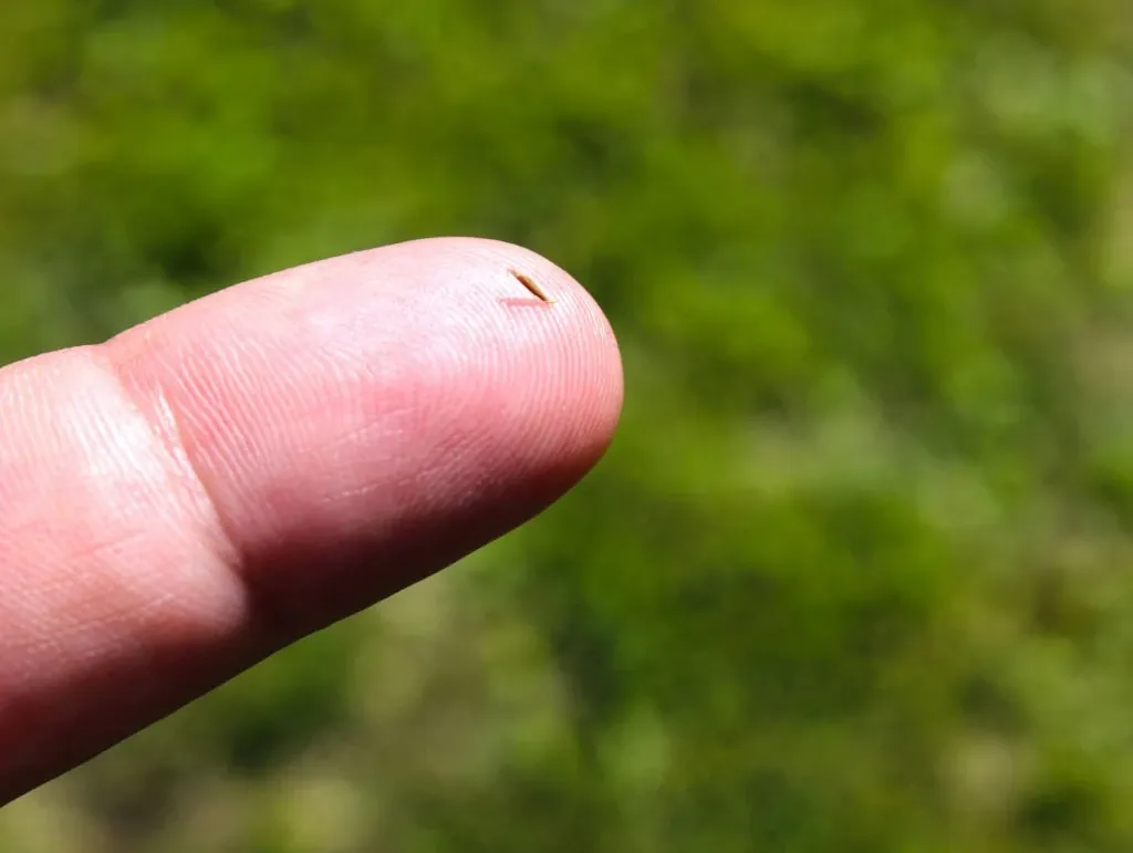 Vücuda Giren Kıymığı Çıkarmanın Yolları